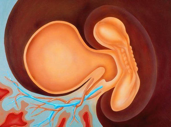 На фото: граница, обозначенная голубым цветом - хорион, вокруг зародыша - амнион (плодный пузырь), и явно виден слева от эмбриона желточный мешок. 