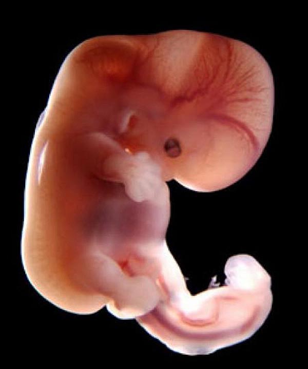 7 nedelya beremennosti embrion