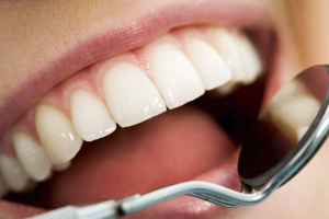 Почернел зуб — причины