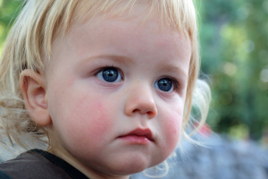 Синусит у детей — симптомы, причины и лечение